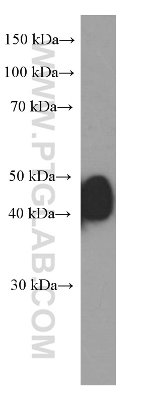 Western Blot (WB) analysis of MCF-7 cells using ESR2 Monoclonal antibody (60197-1-Ig)