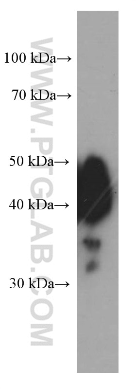 Western Blot (WB) analysis of SW 1990 cells using ESR2 Monoclonal antibody (60197-1-Ig)