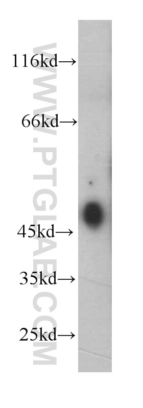 Western Blot (WB) analysis of human brain tissue using ESR2 Monoclonal antibody (60197-1-Ig)