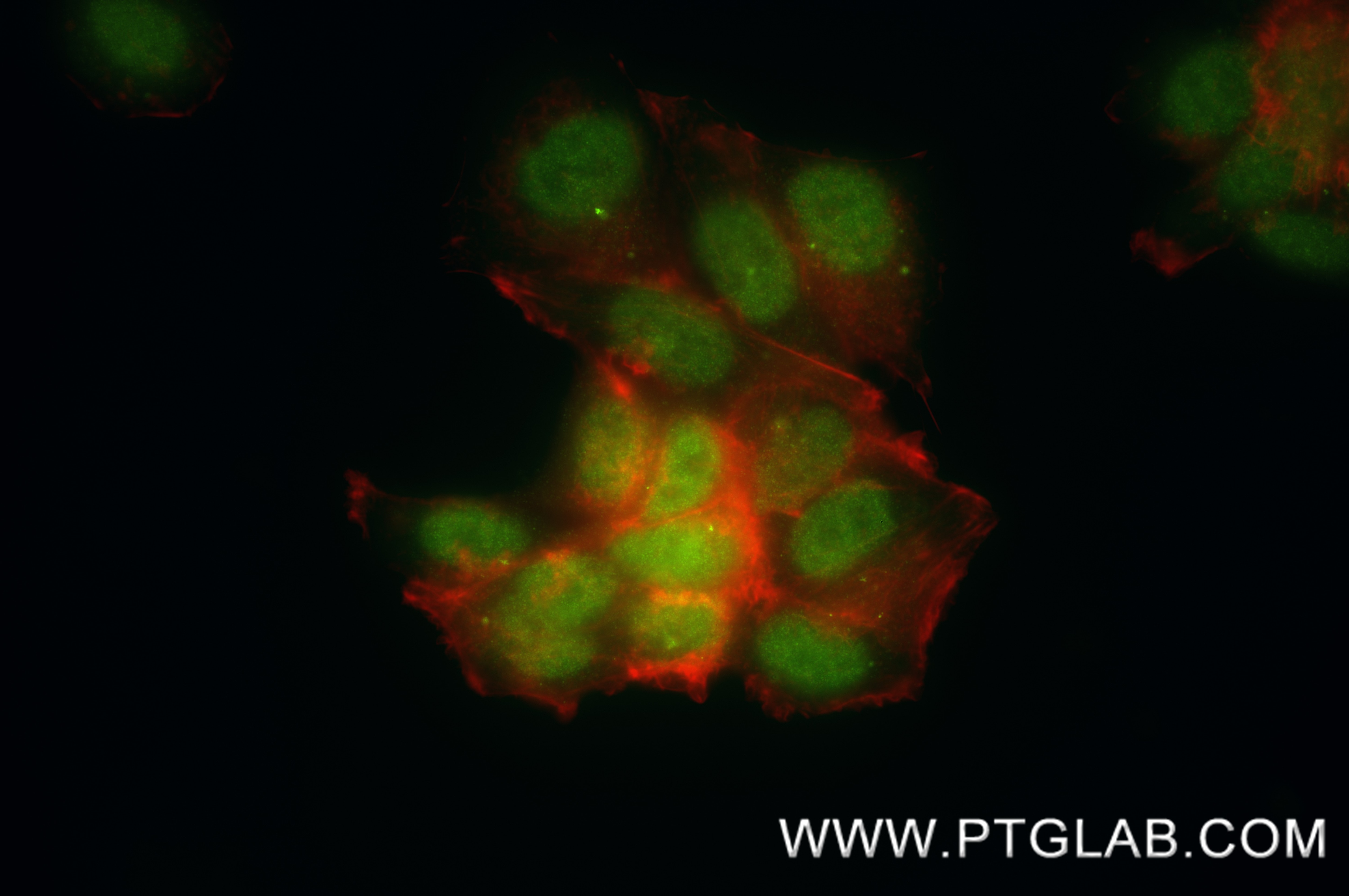 IF Staining of MCF-7 using 83447-3-RR (same clone as 83447-3-PBS) Immunofluorescence (IF) / fluorescent staining of MCF-7 cells using ESR2 Recombinant monoclonal antibody (83447-3-RR)