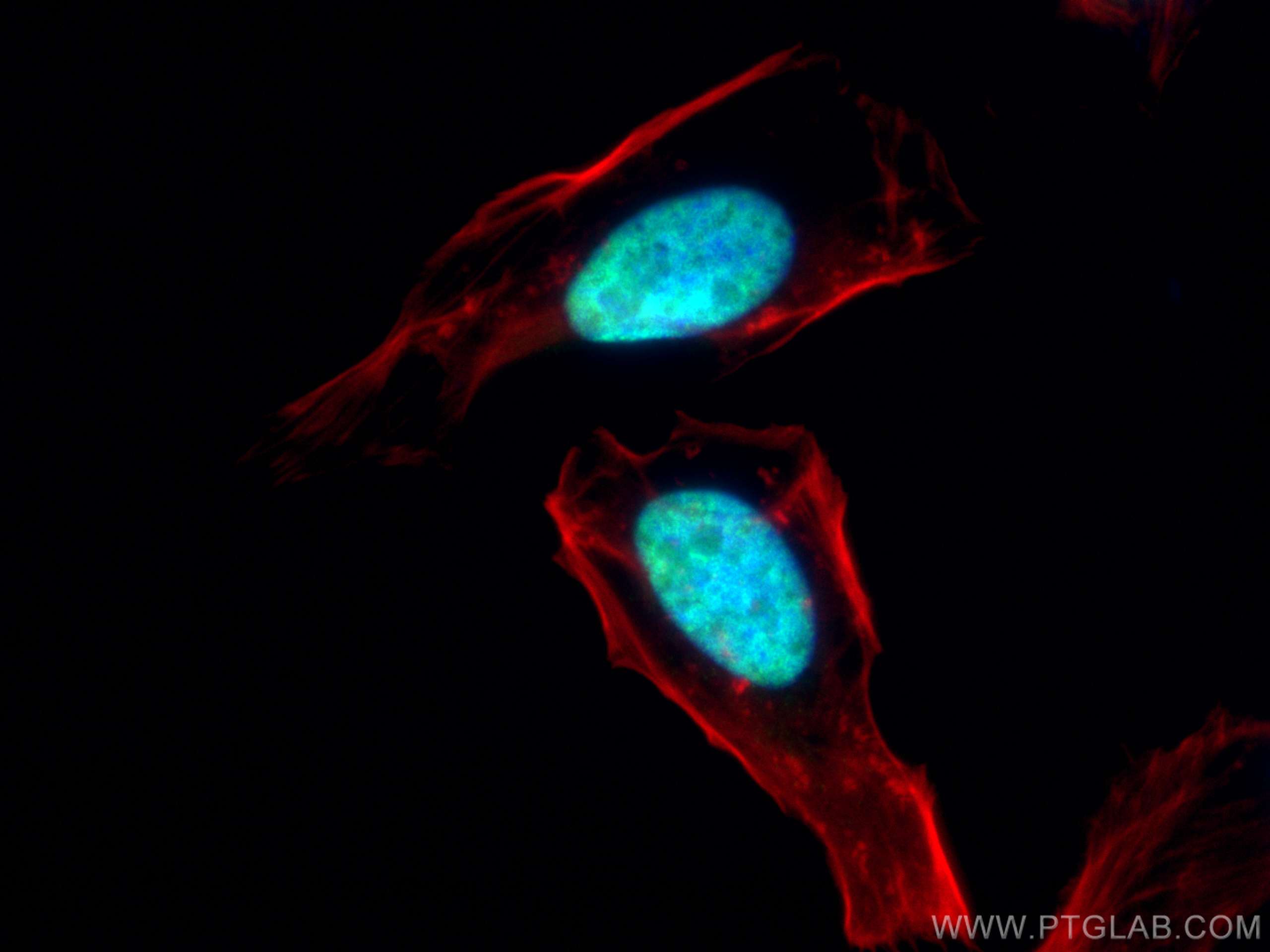 Immunofluorescence (IF) / fluorescent staining of HeLa cells using ESR2 Beta 3 Polyclonal antibody (55441-1-AP)