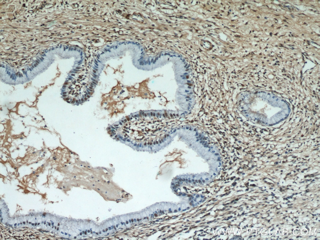 IHC staining of human cervix using 55441-1-AP