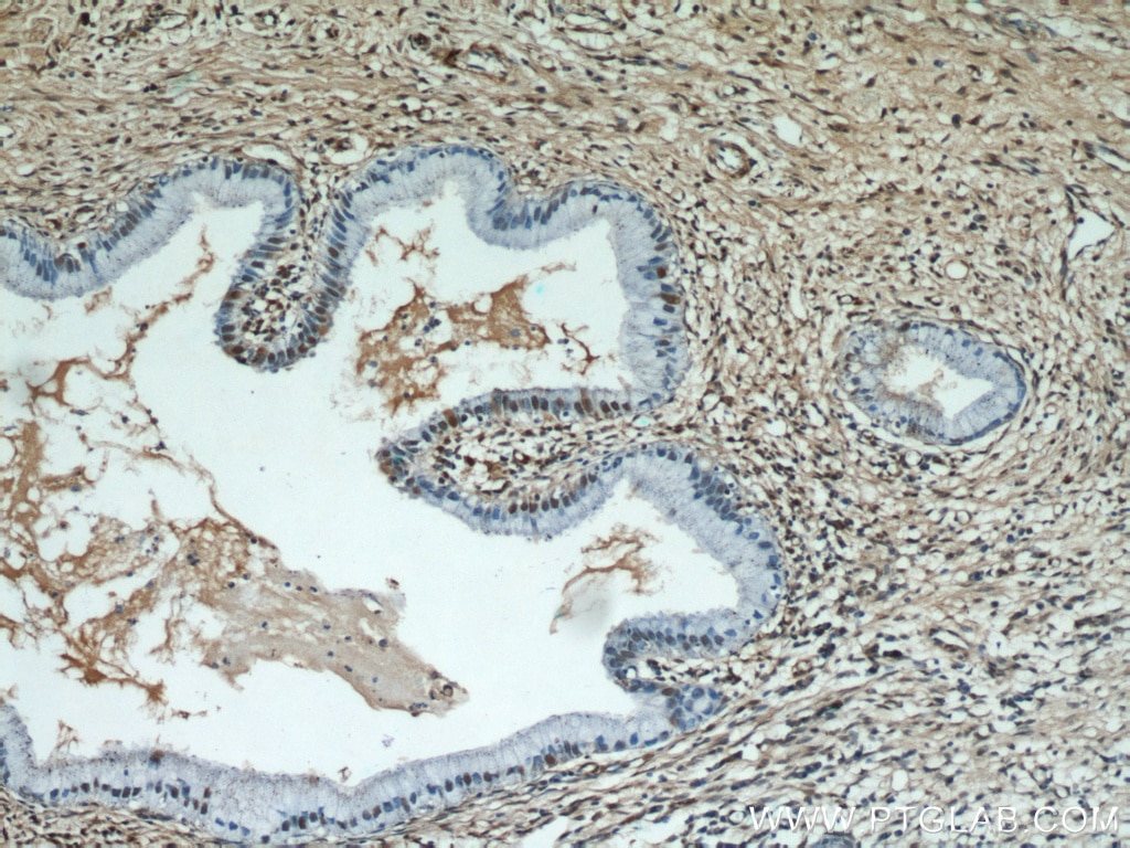 Immunohistochemistry (IHC) staining of human cervix tissue using ESR2 Beta 3 Polyclonal antibody (55441-1-AP)