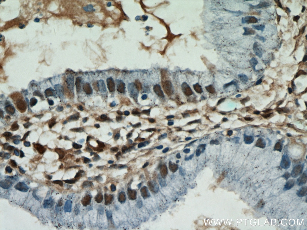 Immunohistochemistry (IHC) staining of human cervix tissue using ESR2 Beta 3 Polyclonal antibody (55441-1-AP)