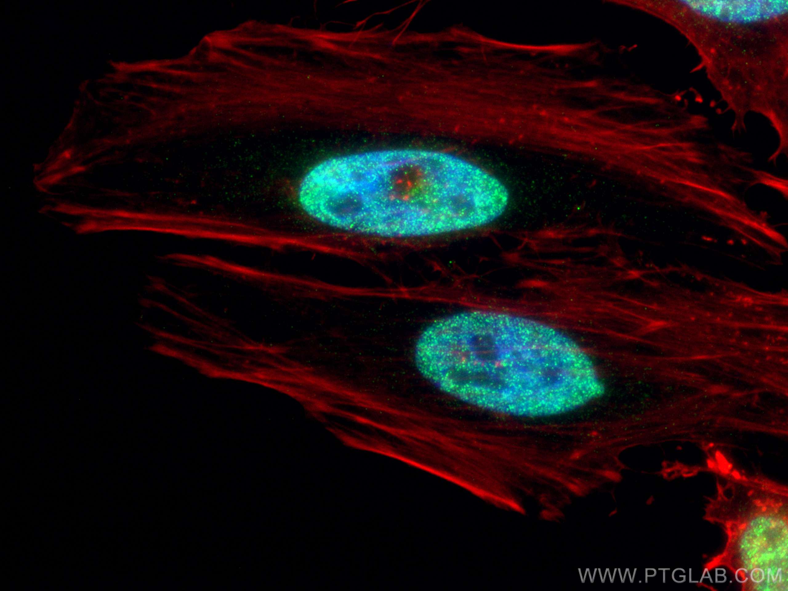 Immunofluorescence (IF) / fluorescent staining of HeLa cells using ESR2 Beta 6 Polyclonal antibody (55471-1-AP)