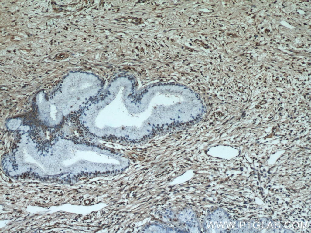 Immunohistochemistry (IHC) staining of human cervix tissue using ESR2 Beta 6 Polyclonal antibody (55471-1-AP)