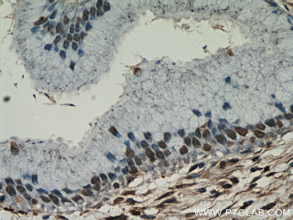 Immunohistochemistry (IHC) staining of human cervix tissue using ESR2 Beta 6 Polyclonal antibody (55471-1-AP)