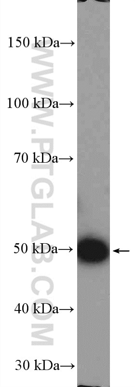 Western Blot (WB) analysis of mouse spleen tissue using ESR2 Beta 6 Polyclonal antibody (55471-1-AP)