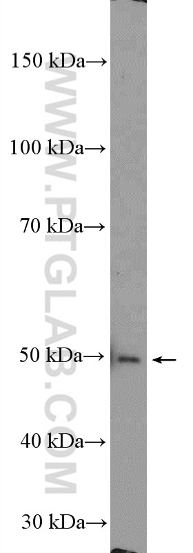 Western Blot (WB) analysis of mouse spleen tissue using ESR2 Beta 6 Polyclonal antibody (55471-1-AP)