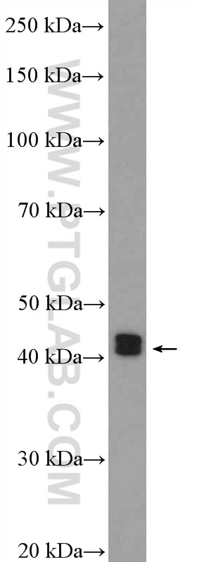 Western Blot (WB) analysis of mouse spleen tissue using ESR2 Beta 6 Polyclonal antibody (55471-1-AP)