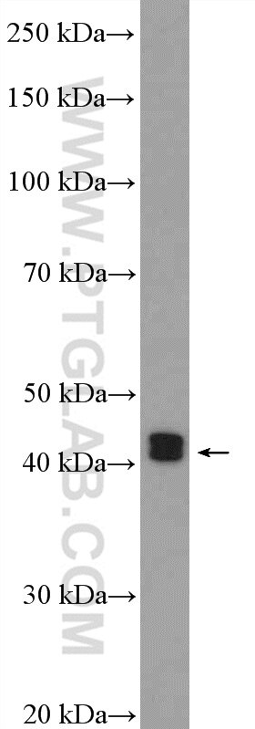 Western Blot (WB) analysis of mouse spleen tissue using ESR2 Beta 6 Polyclonal antibody (55471-1-AP)