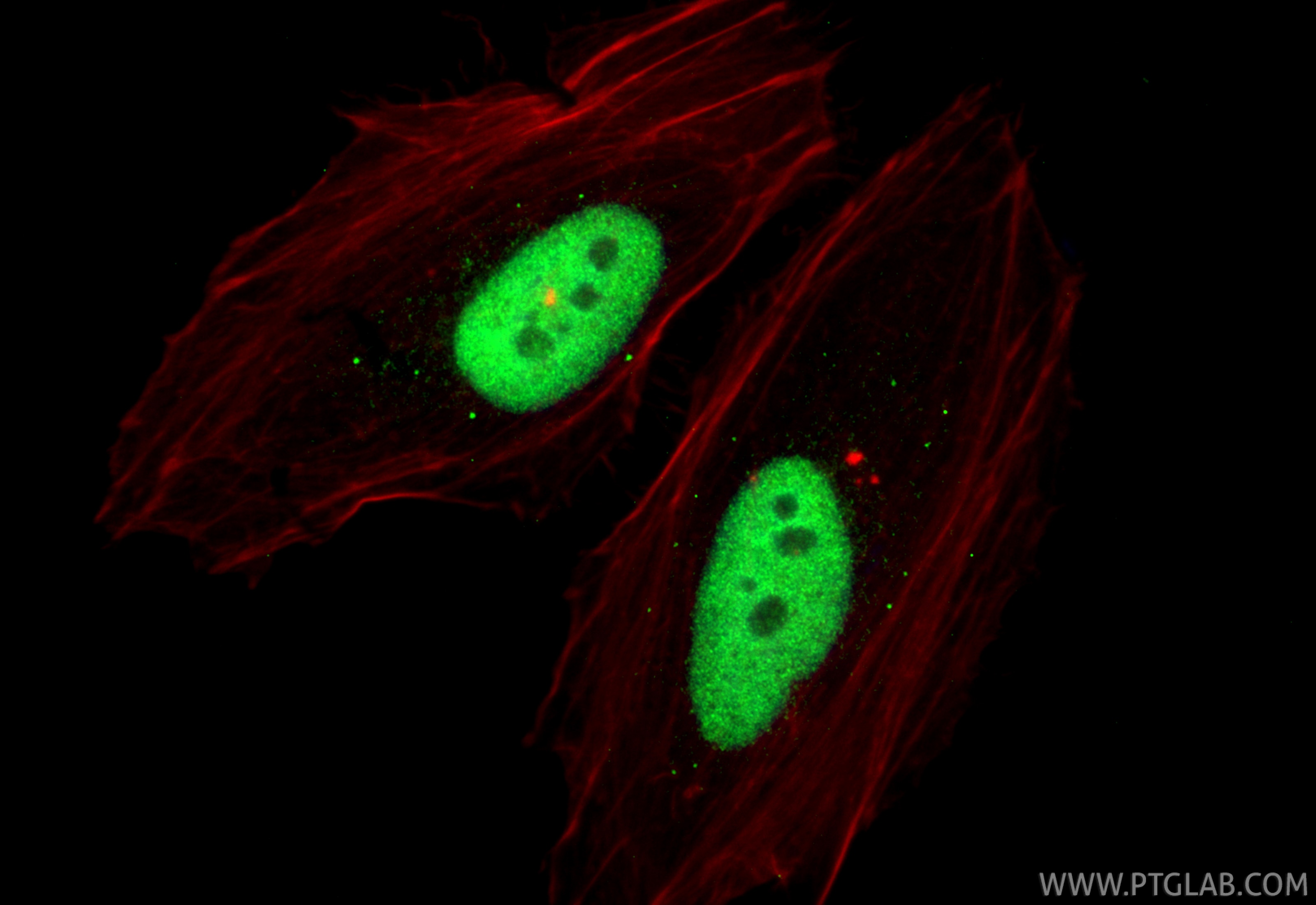 Immunofluorescence (IF) / fluorescent staining of HeLa cells using ESRP1 Polyclonal antibody (21045-1-AP)