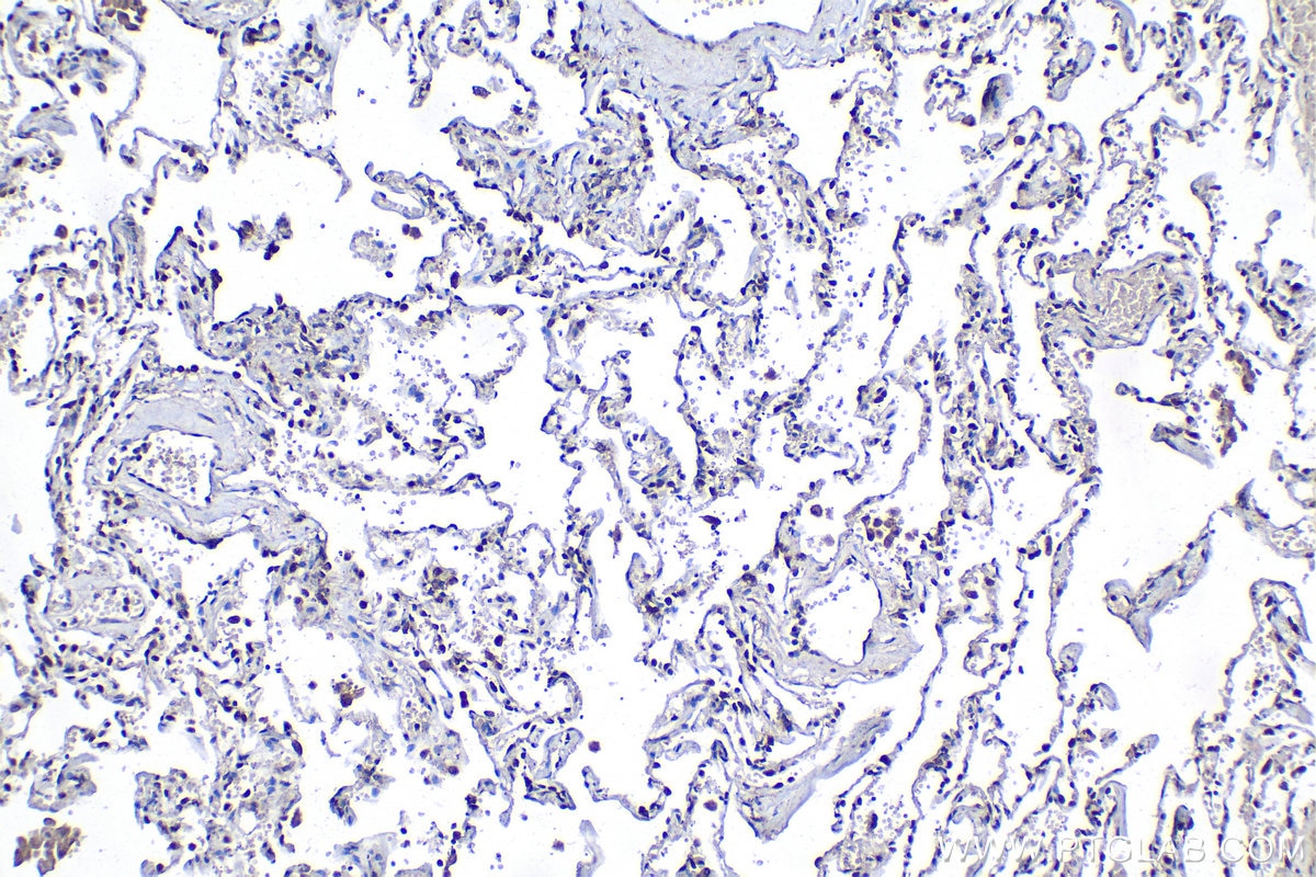 Immunohistochemistry (IHC) staining of human lung tissue using ESRP1 Polyclonal antibody (21045-1-AP)