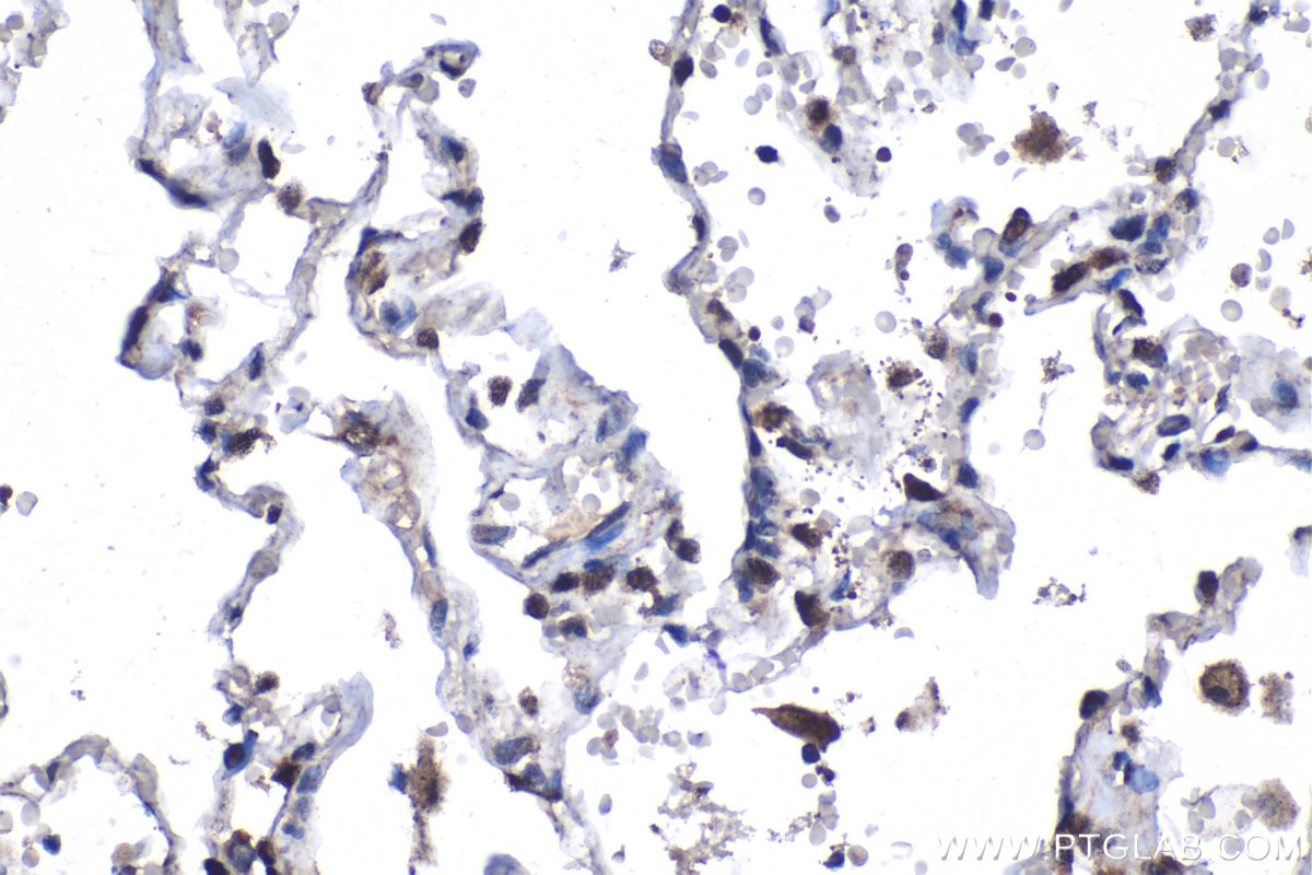 Immunohistochemistry (IHC) staining of human lung tissue using ESRP1 Polyclonal antibody (21045-1-AP)