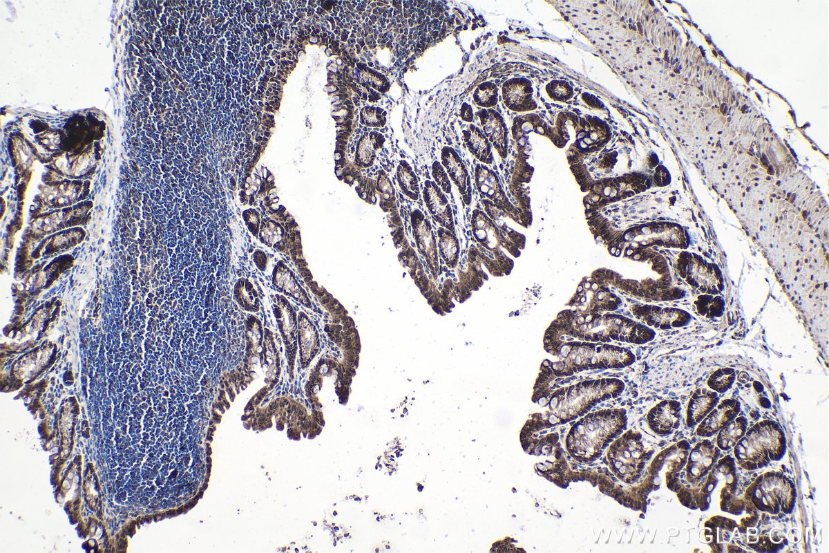 Immunohistochemistry (IHC) staining of mouse colon tissue using ESRP1 Polyclonal antibody (21045-1-AP)