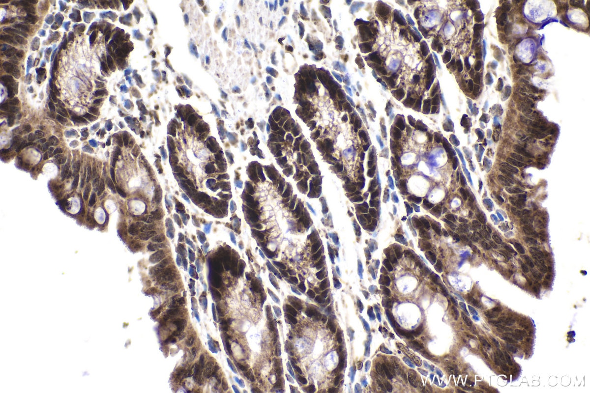 Immunohistochemistry (IHC) staining of mouse colon tissue using ESRP1 Polyclonal antibody (21045-1-AP)