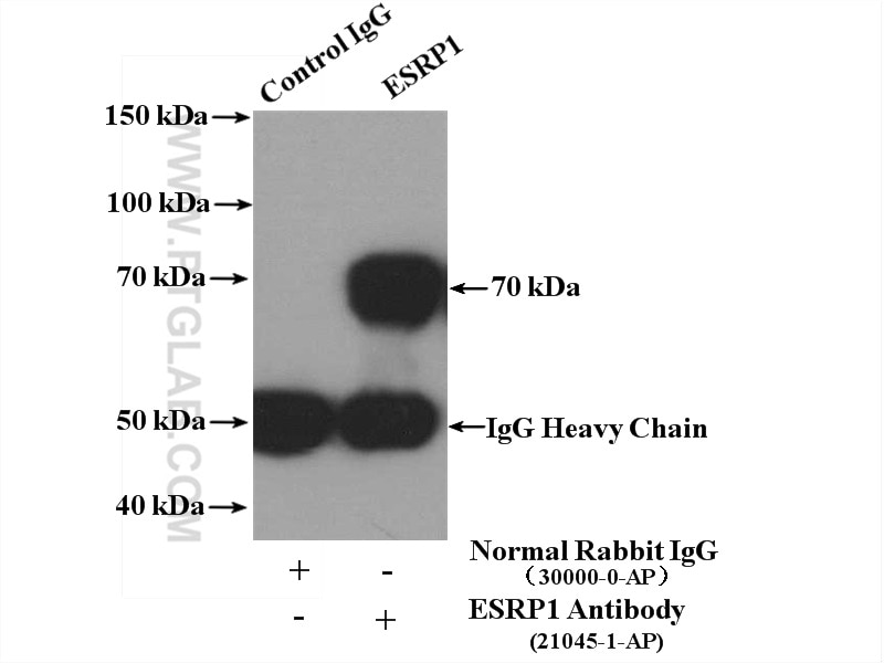 Immunoprecipitation (IP) experiment of COLO 320 cells using ESRP1 Polyclonal antibody (21045-1-AP)
