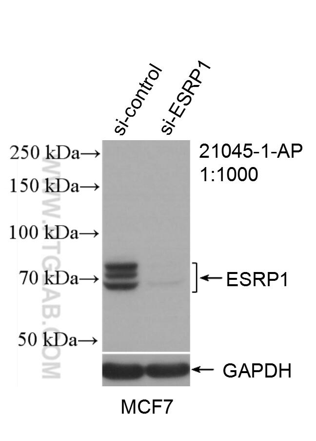 WB analysis of MCF-7 using 21045-1-AP