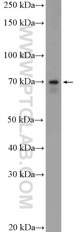 WB analysis of mouse lung using 21045-1-AP