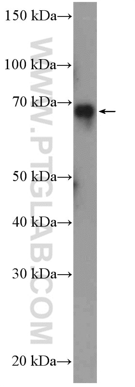 Western Blot (WB) analysis of COLO 320 cells using ESRP1 Polyclonal antibody (21045-1-AP)