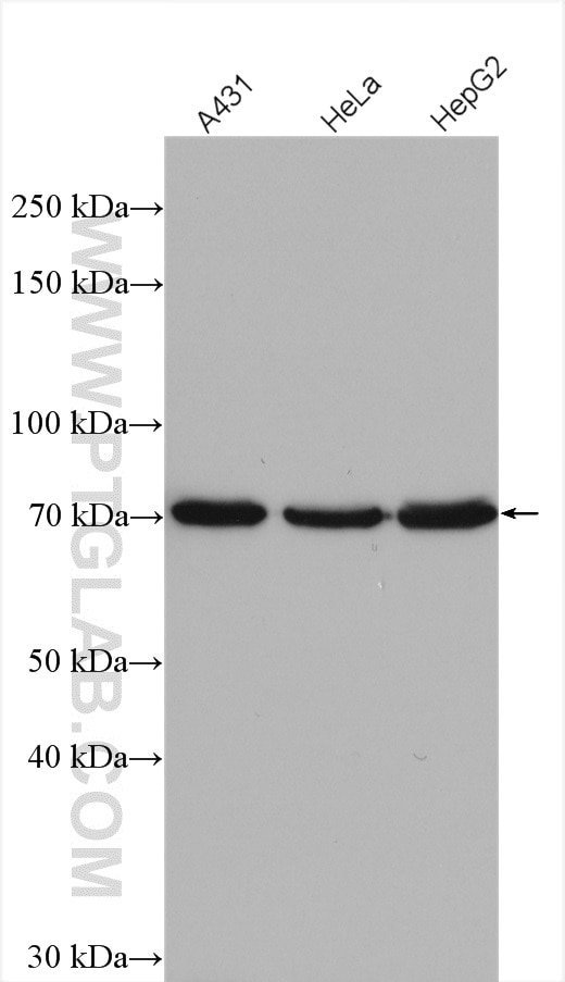 Western Blot (WB) analysis of various lysates using ESRP2 Polyclonal antibody (23117-1-AP)