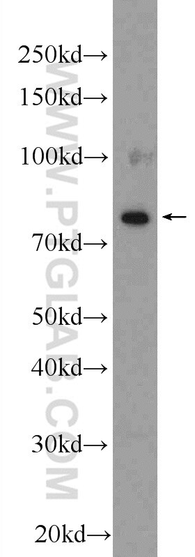 ESRP2