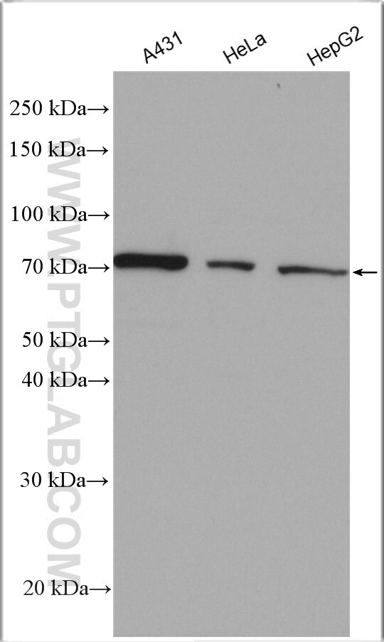 Western Blot (WB) analysis of various lysates using ESRP2 Polyclonal antibody (23117-1-AP)