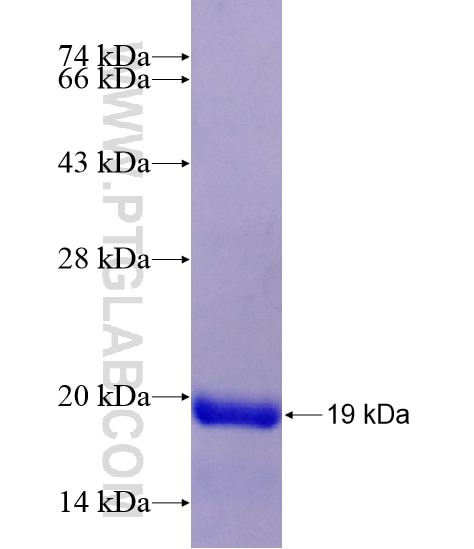 ESRP2 fusion protein Ag19436 SDS-PAGE