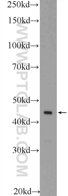 Western Blot (WB) analysis of A549 cells using ESRRB Polyclonal antibody (22644-1-AP)
