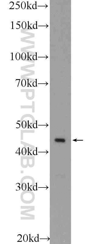 WB analysis of A549 using 22644-1-AP