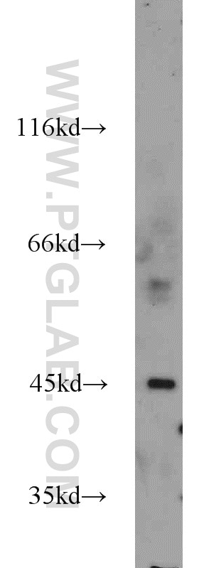 Western Blot (WB) analysis of A549 cells using ESRRB Polyclonal antibody (22644-1-AP)