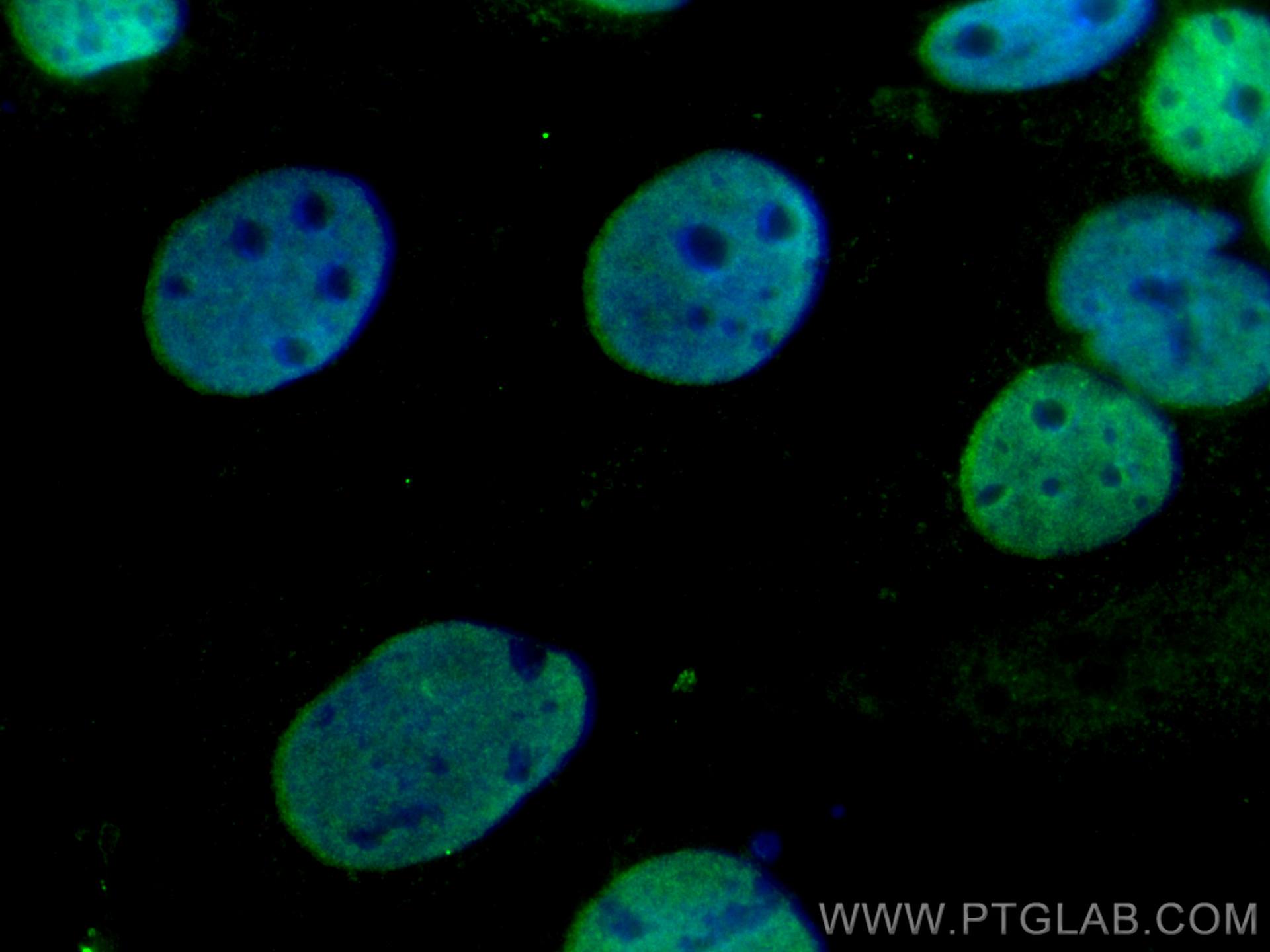 Immunofluorescence (IF) / fluorescent staining of Caco-2 cells using ESRRB Monoclonal antibody (66818-1-Ig)