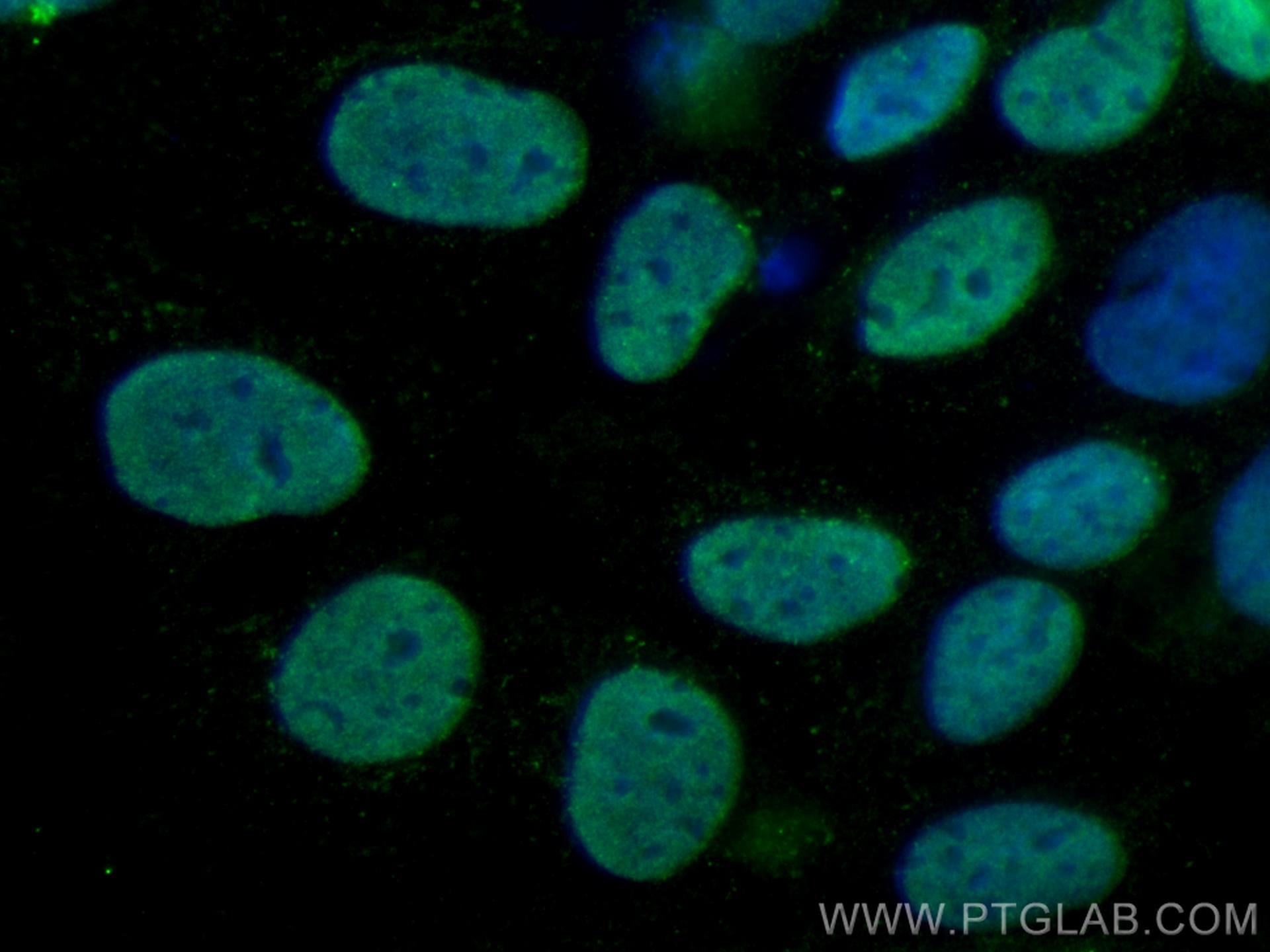 Immunofluorescence (IF) / fluorescent staining of Caco-2 cells using ESRRB Monoclonal antibody (66818-1-Ig)