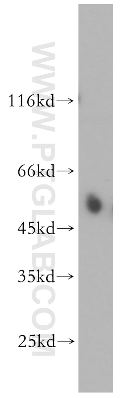 WB analysis of human kidney using 14017-1-AP