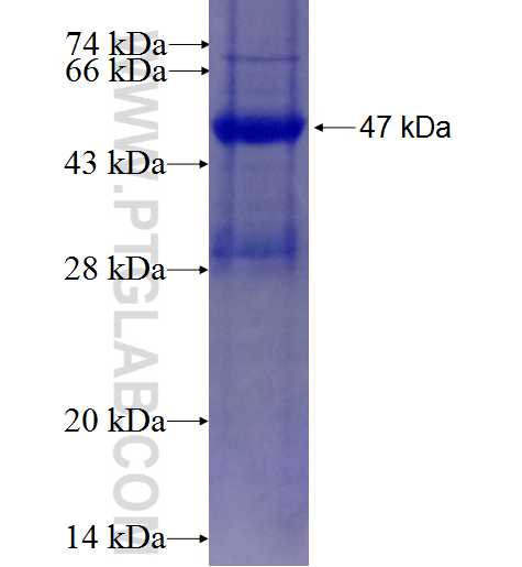 ESRRG fusion protein Ag27555 SDS-PAGE