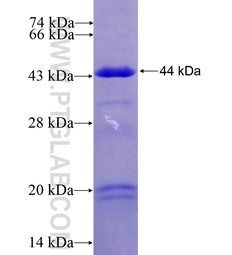 ESRRG fusion protein Ag16660 SDS-PAGE