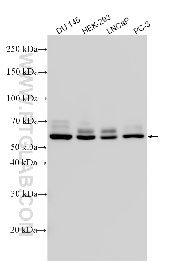 Various lysates were subjected to SDS PAGE followed by western blot with 33574-1-AP ( DGCR14 antibody) at dilution of 1:6000 incubated at room temperature for 1.5 hours. Western Blot (WB) analysis of various lysates using ESS2/DGCR14 Polyclonal antibody (33574-1-AP)