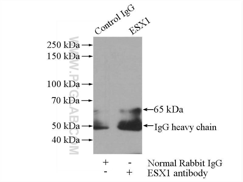 Immunoprecipitation (IP) experiment of mouse brain tissue using ESX1 Polyclonal antibody (14657-1-AP)