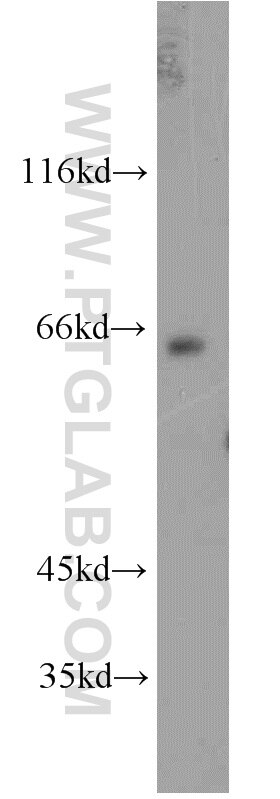 Western Blot (WB) analysis of mouse brain tissue using ESX1 Polyclonal antibody (14657-1-AP)