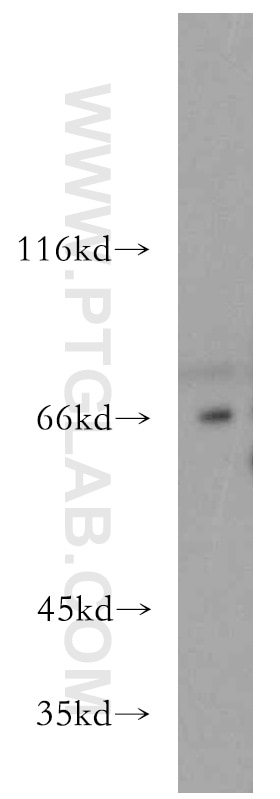 Western Blot (WB) analysis of mouse brain tissue using ESX1 Polyclonal antibody (14657-1-AP)