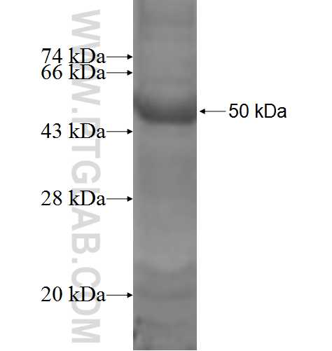 ESX1 fusion protein Ag6269 SDS-PAGE