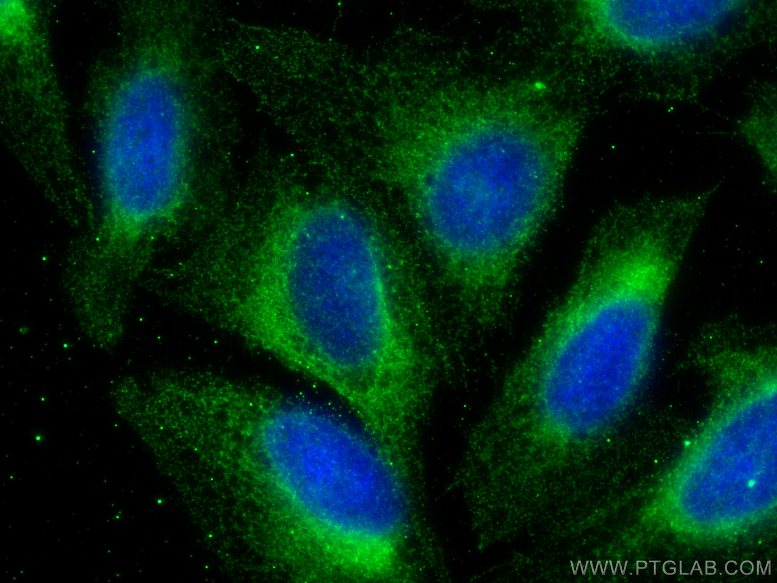 Immunofluorescence (IF) / fluorescent staining of U2OS cells using ESYT1 Monoclonal antibody (67688-1-Ig)