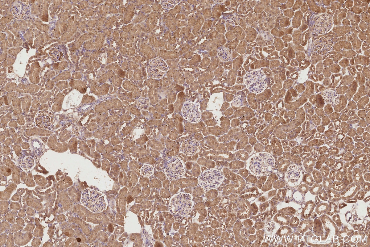 IHC staining of rat kidney using 67688-1-Ig Immunohistochemistry (IHC) staining of rat kidney tissue using ESYT1 Monoclonal antibody (67688-1-Ig)