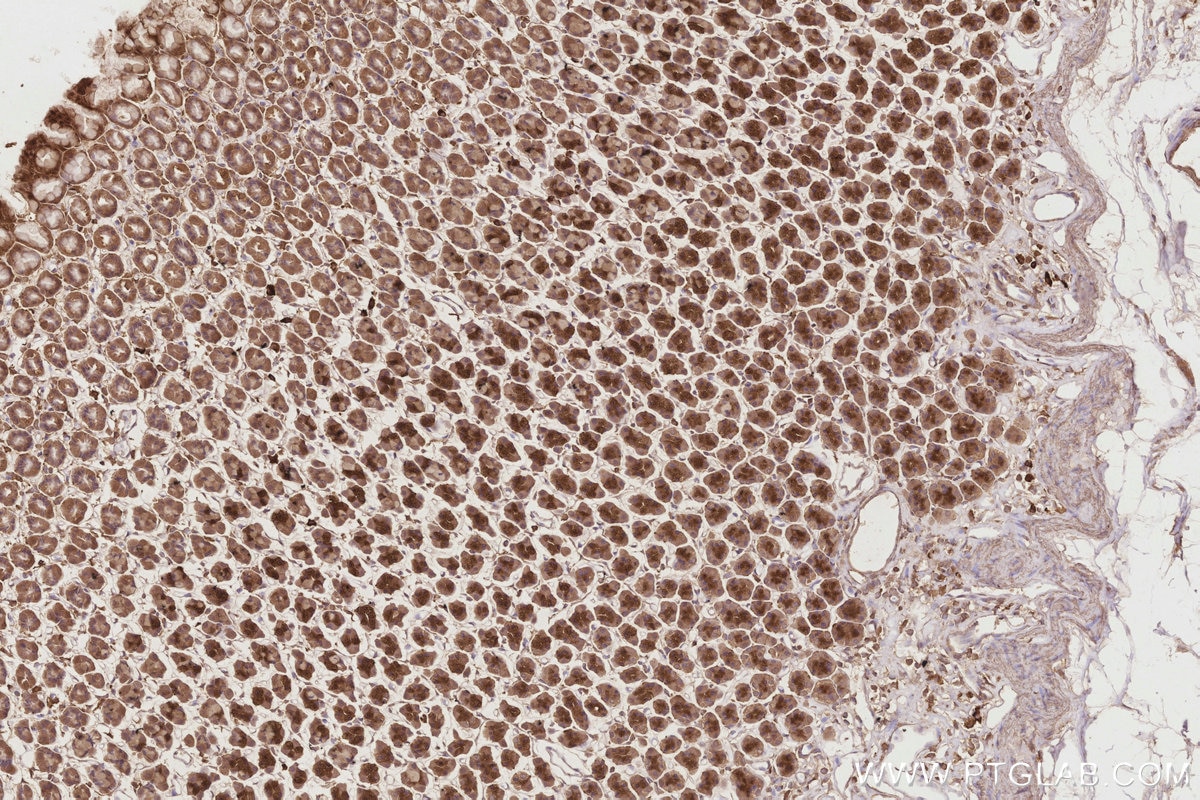 IHC staining of rat stomach using 67688-1-Ig Immunohistochemistry (IHC) staining of rat stomach tissue using ESYT1 Monoclonal antibody (67688-1-Ig)