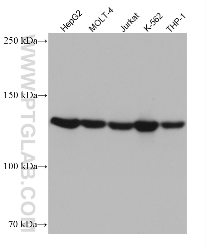 Western Blot (WB) analysis of various lysates using ESYT1 Monoclonal antibody (67688-1-Ig)