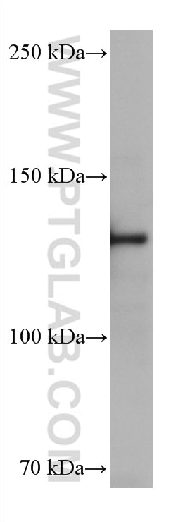Western Blot (WB) analysis of HSC-T6 cells using ESYT1 Monoclonal antibody (67688-1-Ig)