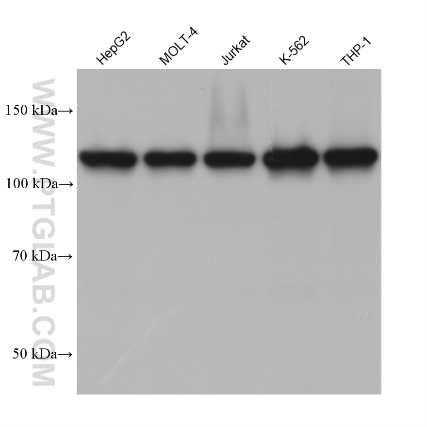 Western Blot (WB) analysis of various lysates using ESYT1 Monoclonal antibody (67688-1-Ig)