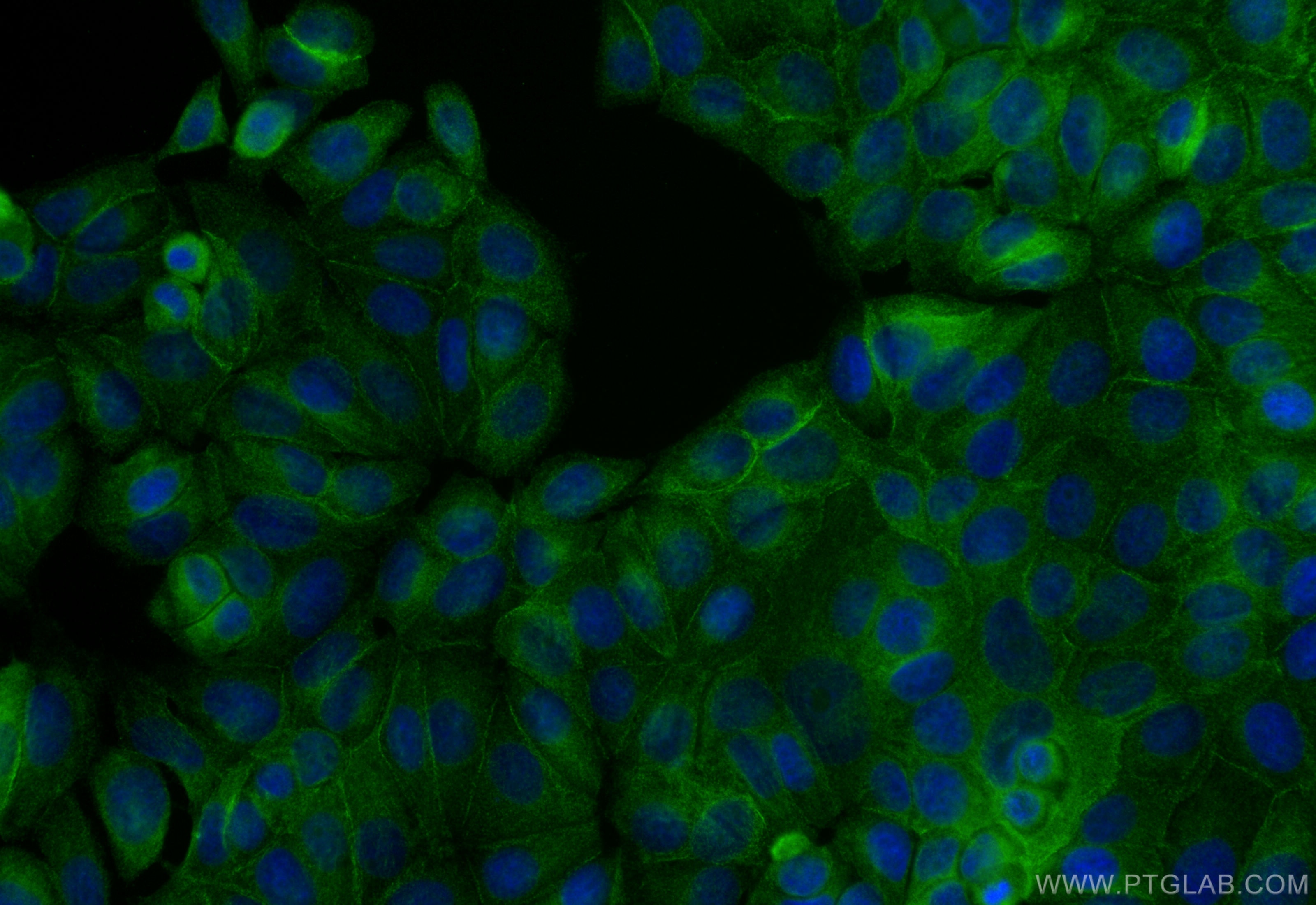 Immunofluorescence (IF) / fluorescent staining of MCF-7 cells using ESYT2 Monoclonal antibody (68374-1-Ig)