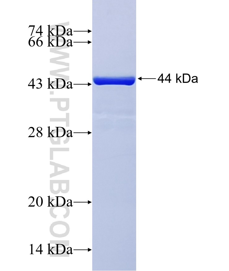 ETAA1 fusion protein Ag36606 SDS-PAGE ETAA1 fusion protein Ag36606 SDS-PAGE