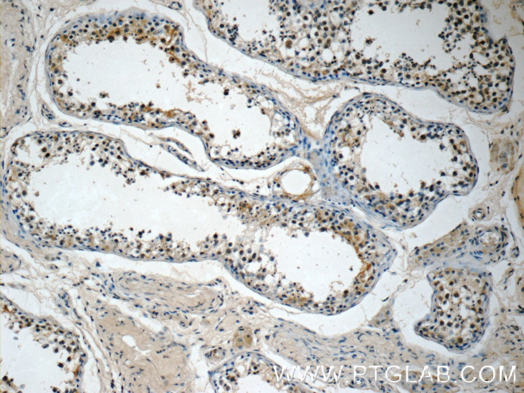 Immunohistochemistry (IHC) staining of human testis tissue using ETF1 Polyclonal antibody (10884-1-AP)